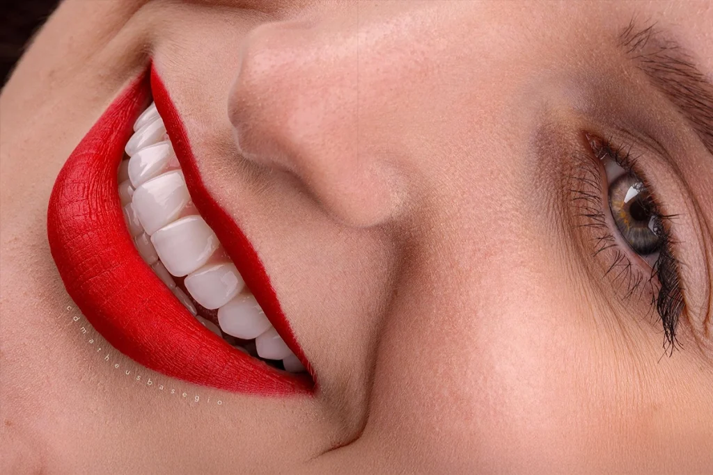 Dental Veneers Treatment Near me