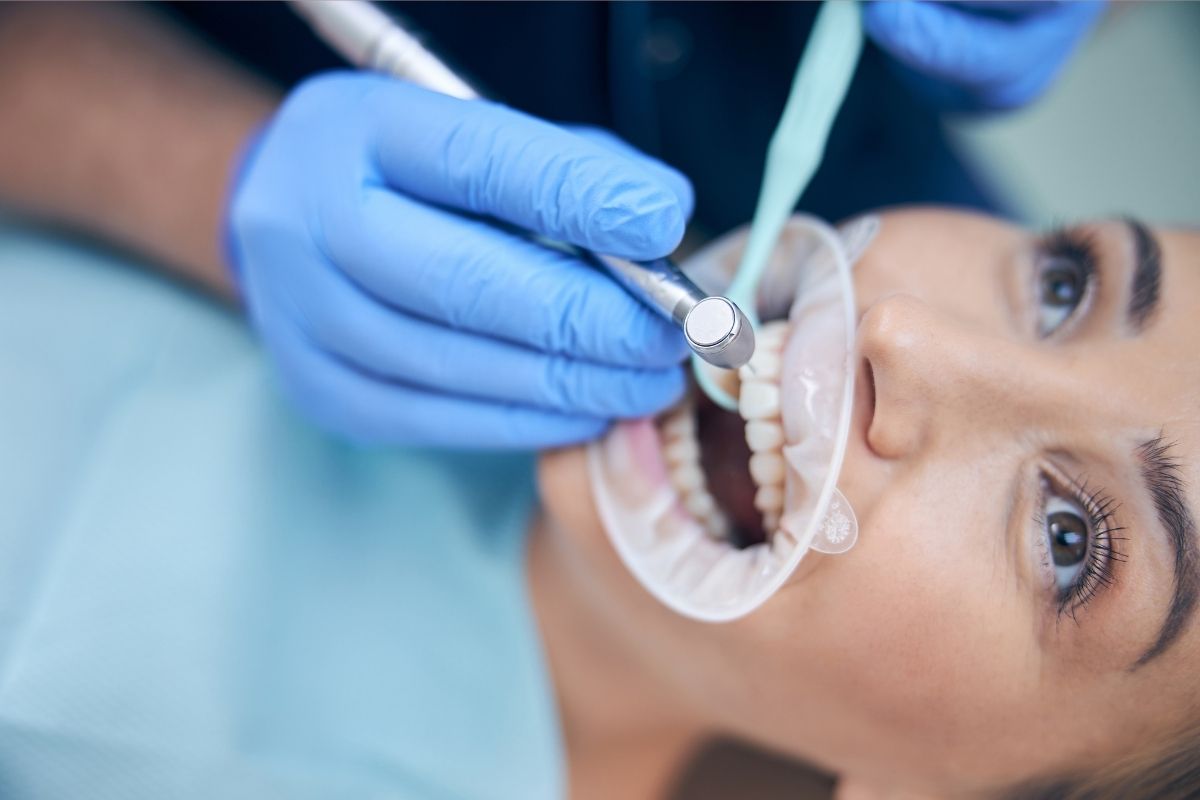 Dental Crowns aftercare 2025