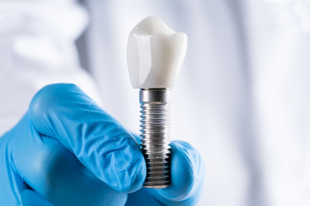 Dental Implant Package 2025