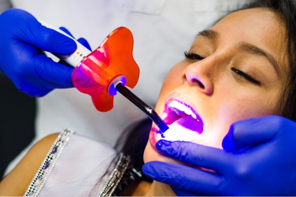 Is Teeth Whitening Safe