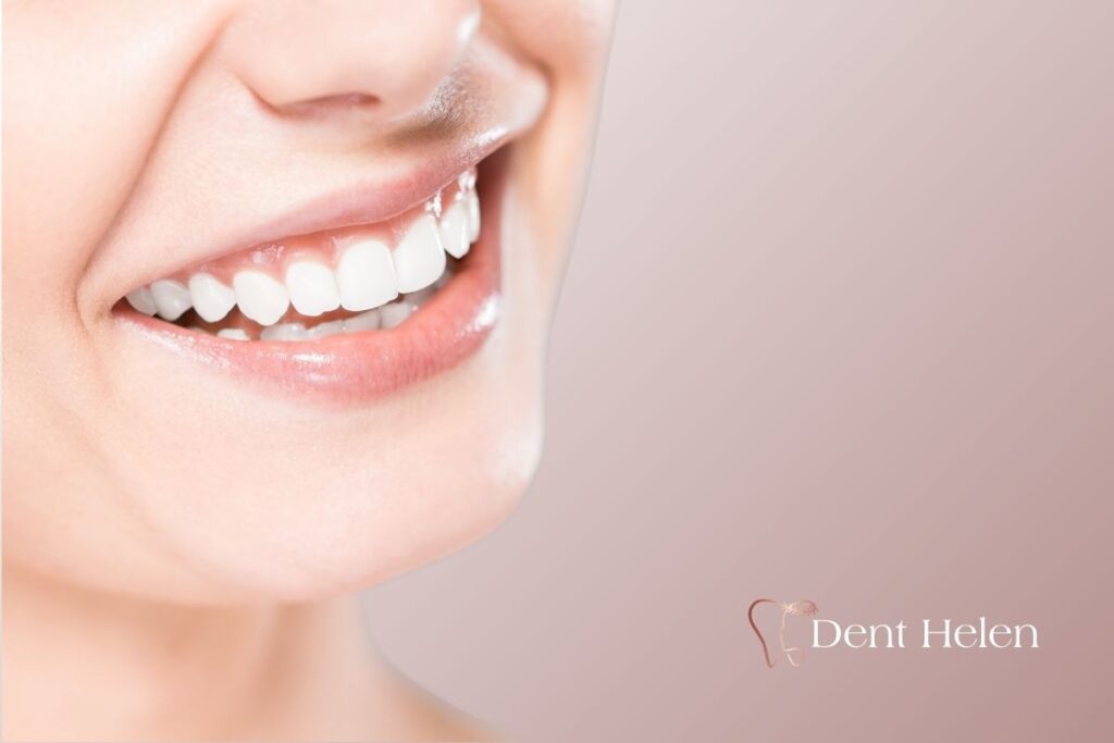 Teeth Whitening Process Work in Antalya