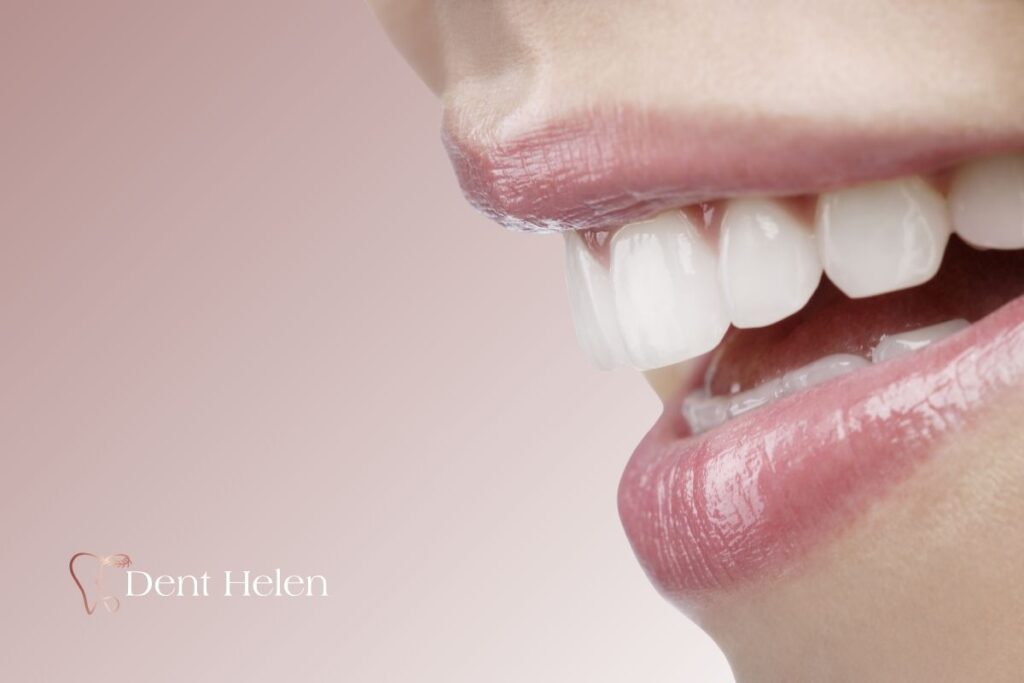 Facettes dentaires prix à Antalya