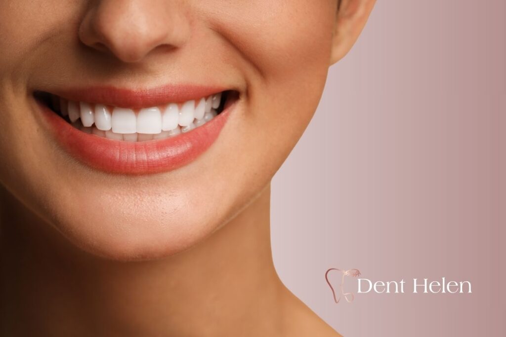 Dental veneers in Turkey