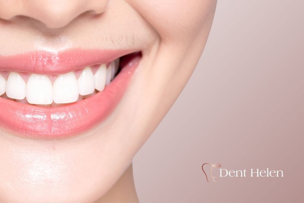 Dental Crowns Cost in the UK vs Antalya