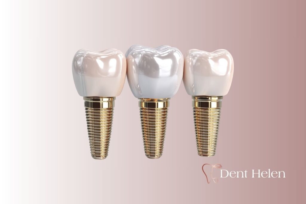 Douleur après implant dentaire