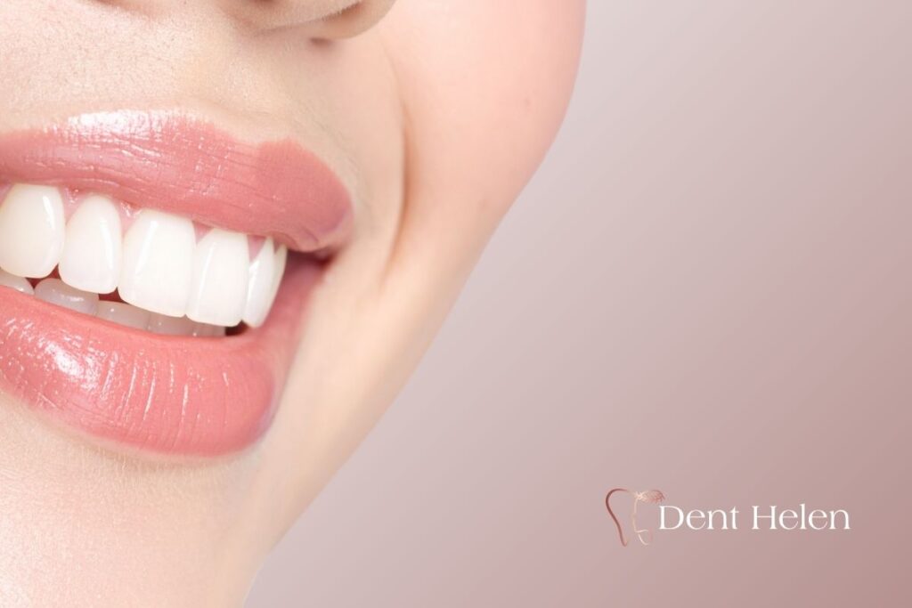 Why Many Patients Choose Antalya for Dental Crowns