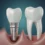 Dental Implants vs Dentures