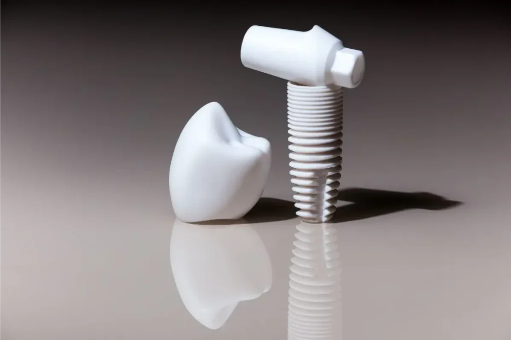 Dentures vs Dental Implants: Which Tooth Replacement Is Better?