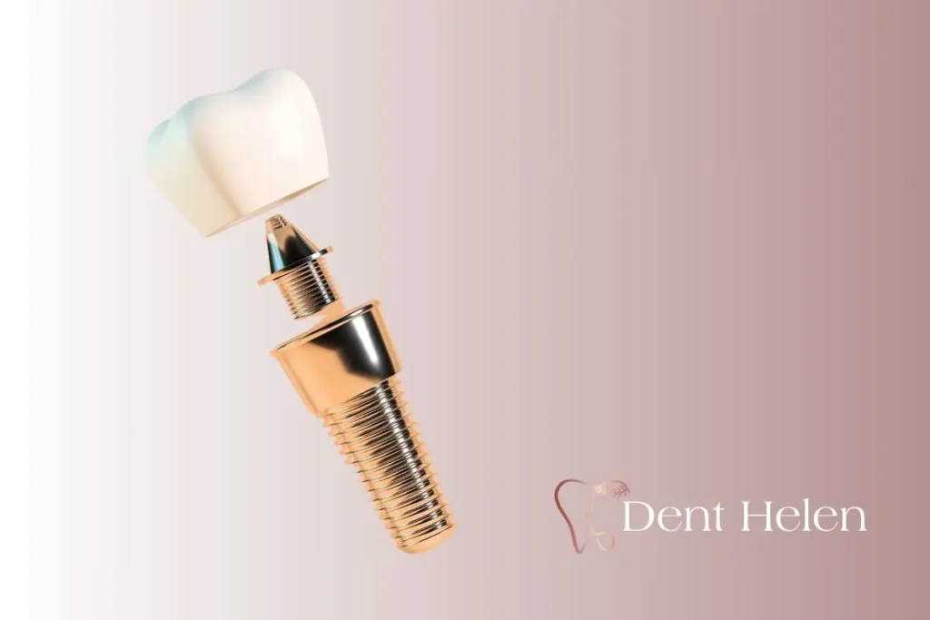 All-on-4 Dental Implants Cost in Turkey