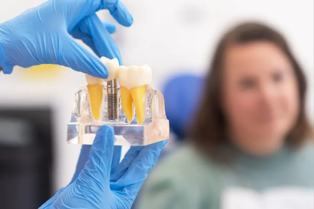 Como Recuperar Mais Rápido Após Implantes Dentários em Antália