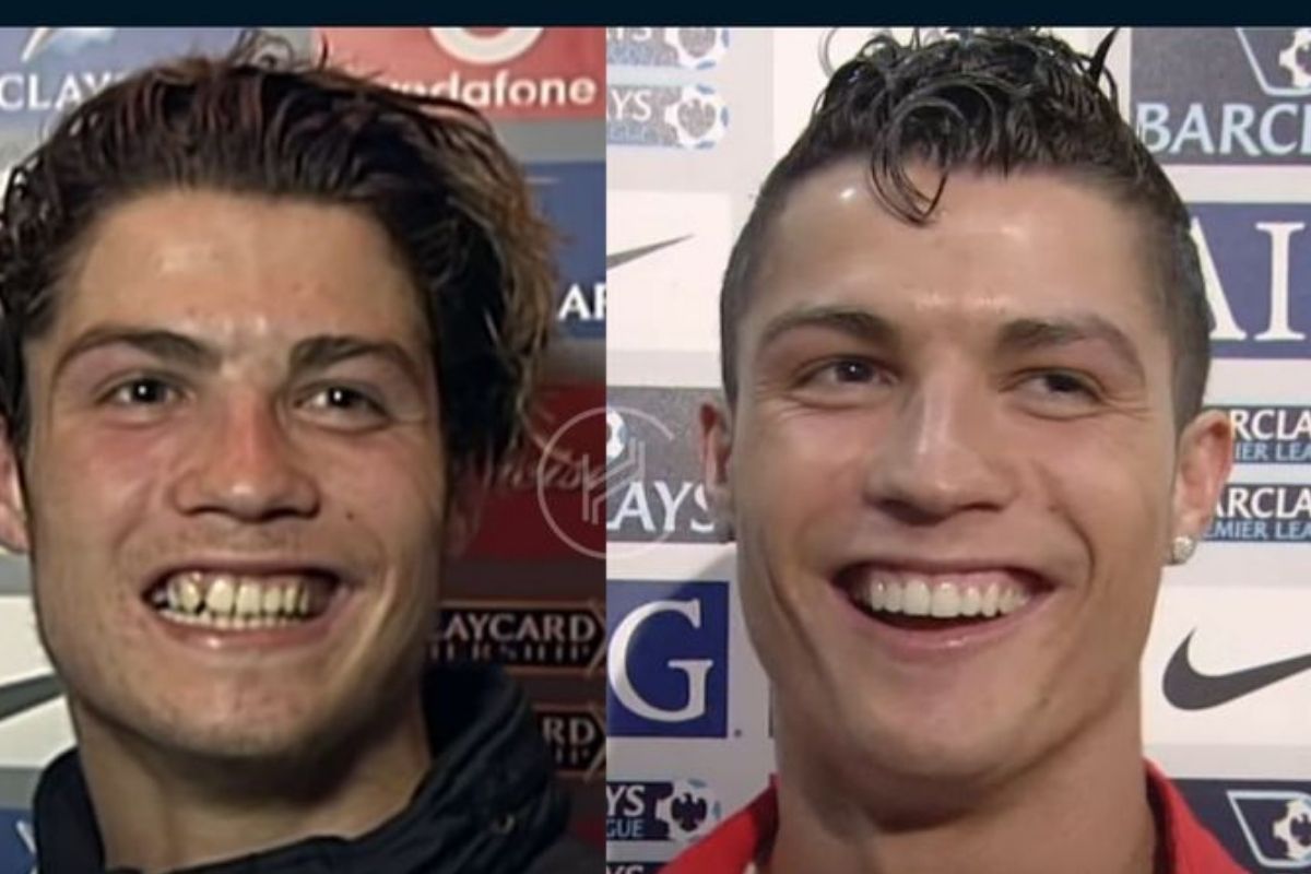 Cristiano Ronaldo hambad enne ja pärast muutus