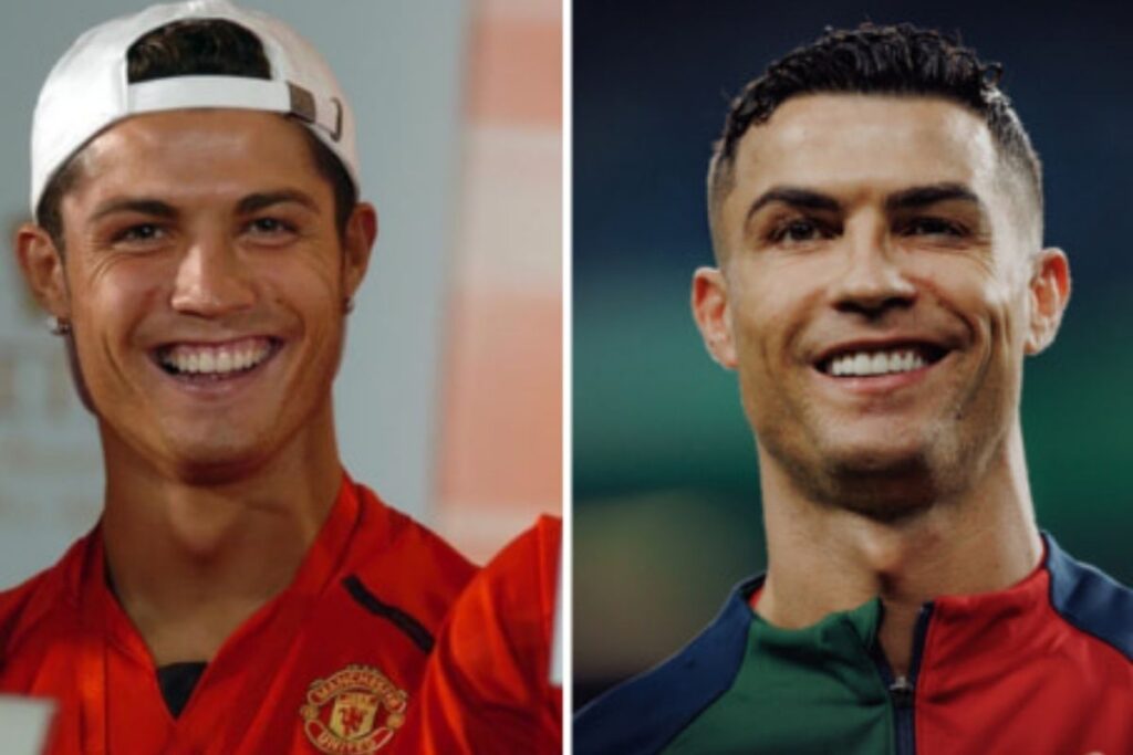 Cristiano Ronaldo hambad: enne ja pärast muutus