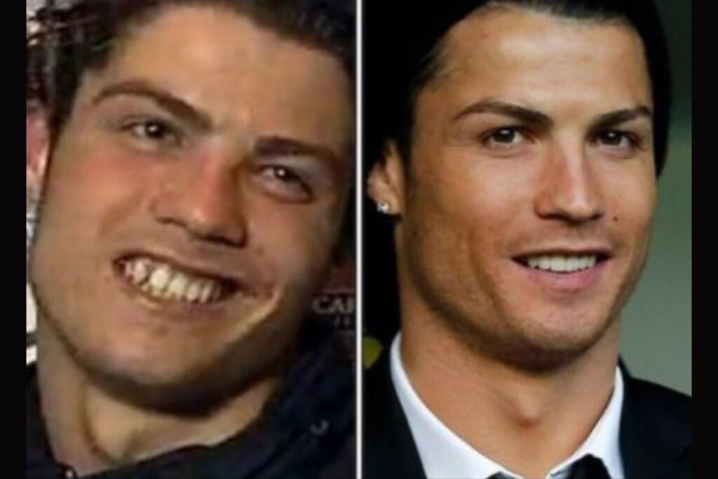 Cristiano Ronaldo hambad: enne ja pärast muutus