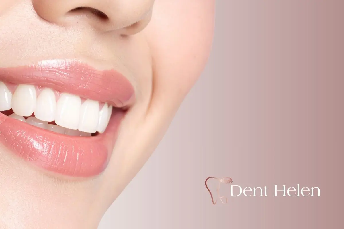 Branqueamento Dentário Preço