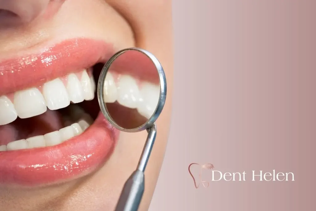 No-Prep Composite Bonding vs Veneers