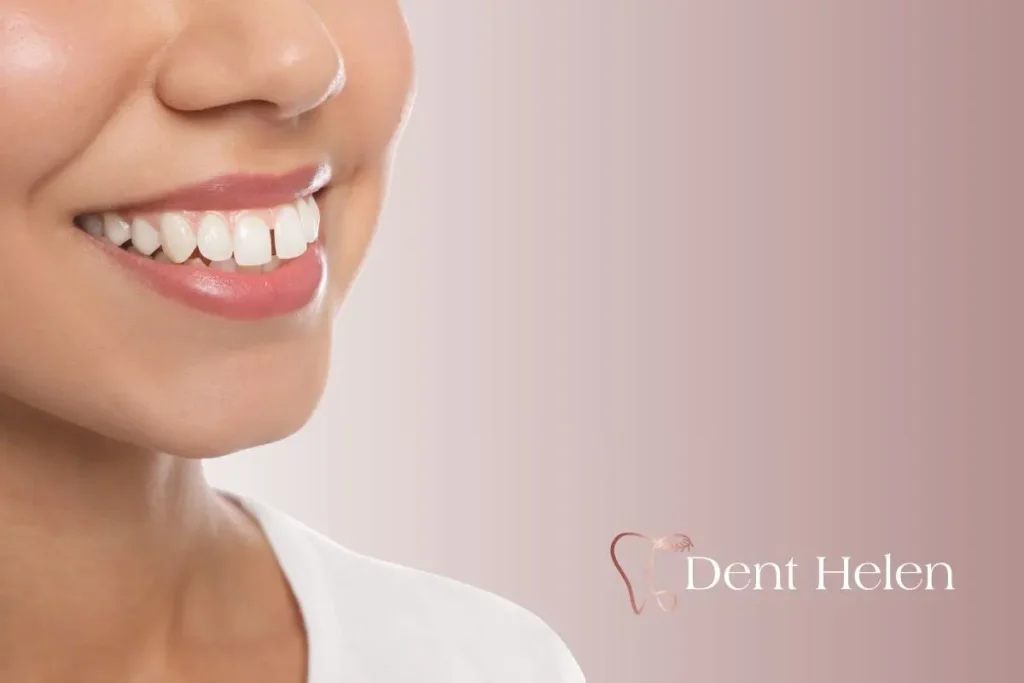 Qual é o preço de branqueamento dentário no dentista