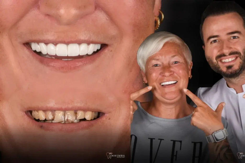 Zubní ošetření v Antalyi
